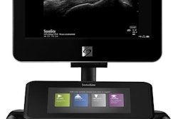2017 11 30 21 51 3122 Fujifilm Sonosite X Porte 20171130215345