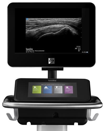The X-Porte ultrasound system. Image courtesy of Fujifilm SonoSite.