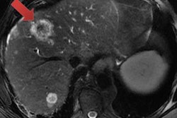 2017 11 30 22 46 1004 Kras Daye 20171130221822