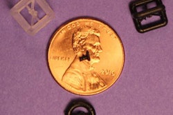 2017 11 28 01 30 4502 3 D Printing Prosthetic 20171128012021