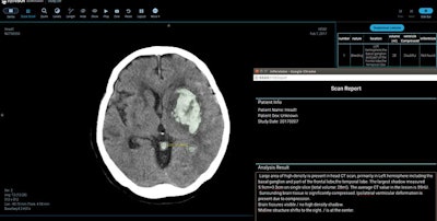 Infervision's AI-CT Stroke Screening System is designed to help radiologists find and diagnose stroke on brain CT scans. Image courtesy of Infervision.