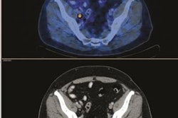 2017 12 06 18 20 7949 Pet Prostate Jnm 20171206183455