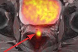 2017 12 08 18 29 3110 2017 12 11 Sawiki Pet Mri Pelvic 20171208181055