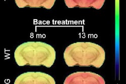 2017 12 15 23 13 3928 Florbetapir Jnm Mice Study 20171215233803