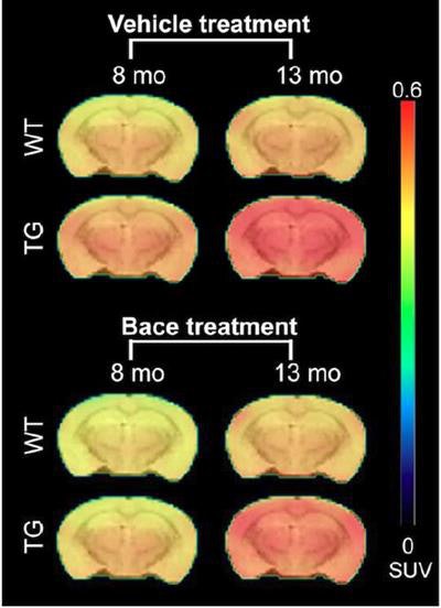 PET shows the average florbetapir uptake per mouse group at 8 and 13 months of age. A significant interaction of genotype treatment was observed in the cortex (p = 0.0248), hippocampus (p = 0.0071), and thalamus (p = 0.0084), indicating reduced florbetapir uptake in BACE1-inhibited mice. WT = wild type (controls); TG = transgenic (genetically modified). Image courtesy of the Molecular Imaging Center Antwerp and JNM.