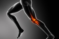 2017 12 18 21 06 2090 Running Knee Pain 400