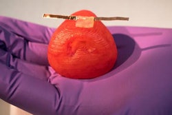 2017 12 21 19 39 3002 3 D Printing Prostate 20171221193319