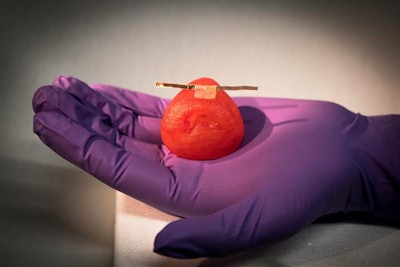 3D-printed prostate with the texture and elasticity of a real prostate. Image courtesy of Michael McAlpine, PhD.