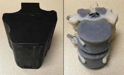 3D-printed spinal model visible on CT and MRI (left). Internal structure of the model (right). All images courtesy of Dimitris Mitsouras, PhD.