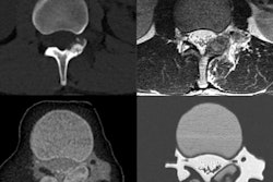 2017 12 22 21 46 0626 Mitsouras 15 Patient Vs Model 400