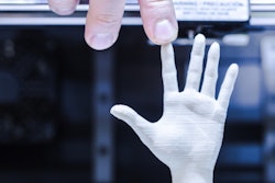 2017 09 21 16 19 8287 3 D Printing Hand Half 400