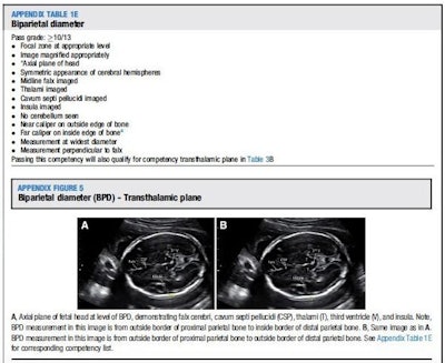 Biparietal diameter along with the list of criteria for competency: A teaching example from the curriculum that describes how an important measurement of a developing fetus is made. Image courtesy of the American Journal of Obstetrics and Gynecology.