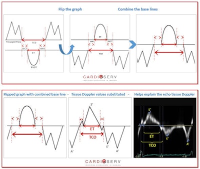 Flipped diagram