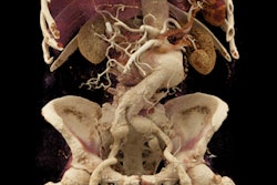 2018 01 24 19 21 2673 Cinem Rend Aorta 400