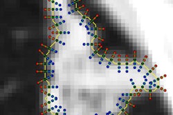 2018 01 29 19 04 3956 Ai2 Alilou Cropped 20180129194757