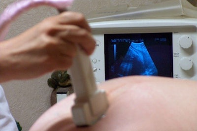 A UIC researcher using imaging to identify women at risk of giving birth prematurely. Image courtesy of UIC.
