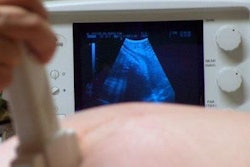 2018 01 30 21 11 7101 Premature Us 400 20180130212522