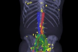 2018 02 02 17 24 8388 Pet Ct Jnm Prostate 20180202174556