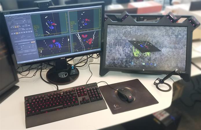 2D/3D hybrid interface refreshes diagnostic imaging | AuntMinnie