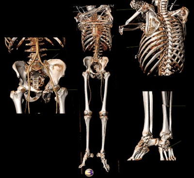 2018 02 24 00 44 4815 2018 02 28 3 D