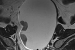 2018 03 01 07 10 6235 2018 03 01 10 Min Mri Thumb 20180301070049