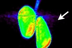 2018 03 02 00 29 4323 Adnectin Pd L1 20180302001257