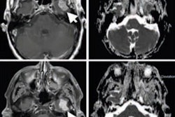 2018 03 02 05 05 0339 2018 03 02 Immunotherapy 20180302055502