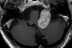 2018 03 02 06 07 8916 2018 03 02 Gadolinium2 20180302062418