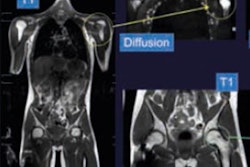 2018 03 03 19 11 3915 2018 03 04 Msk Tumors1 20180303193440