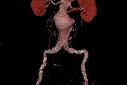 2018 03 03 21 06 8131 Sf17b Fig 1c 20180303214353