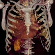 2018 03 03 21 33 6946 2018 03 04 Polytrauma2 Thumb