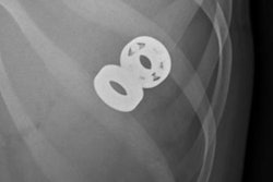 2018 03 07 22 35 5581 Fidget2 20180307222045