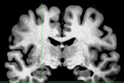 2018 03 08 18 50 4928 Fmri Neuron 20180308185940