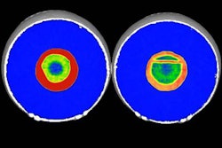 2018 03 15 21 23 8608 Baseballs Ct 20180315215348