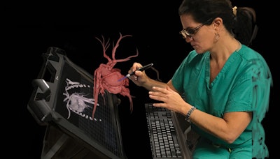 Physicians can examine medical images of vasculature as a holographic display through EchoPixel's True 3D augmented reality platform. Image courtesy of Dr. Zlatko Devcic.