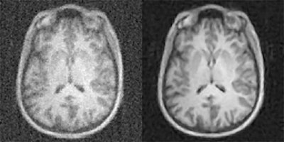 AUTOMAP uses AI to speed up the acquisition of MRI exams and reduce radiation dose in x-ray, CT, and PET scans. Images courtesy of the Athinoula A. Martinos Center for Biomedical Imaging at MGH.
