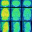 2018 04 03 17 21 4700 Pet Ligand Rat Dementia 20180403170249