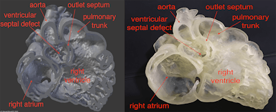 Virtual heart model (left) and 3D-printed heart (right).