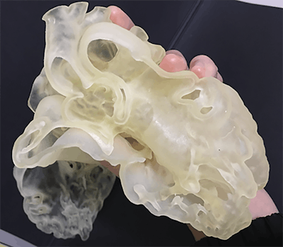 Demonstration of the flexibility of a 3D-printed heart made of TangoPlus material. All images courtesy of Dr. Zhonghua Sun.
