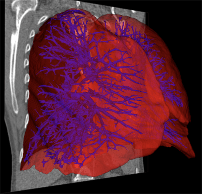 Aether’s ASAR software uses AI to automatically segment medical images of organs. Image courtesy of Aether.