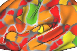 2018 04 18 18 50 1262 Fc Mri Brain Activity 20180418180631 jpg