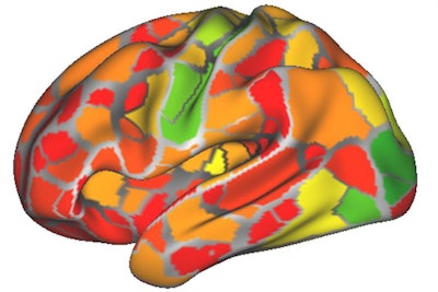 The researchers created the heat map using data from the brain networks of nine people. The map shows the areas of most (red) to least (green) change from person to person. Image courtesy of Caterina Gratton, PhD.