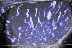 2018 04 23 17 06 3169 2018 04 23 Philips Ultrasound Philips 20180423175139