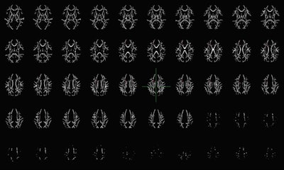 Axial view of white-matter tracts in the brain. Computer analysis was used to determine statistically significant differences between those with cocaine use disorder and healthy subjects. Image courtesy of Abbey Goodyear.