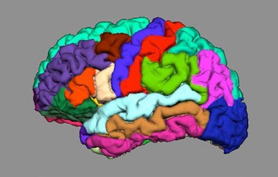 Simplified representation of cortical folding in different brain regions. Image courtesy of University Psychiatric Clinics Basel.