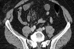 2018 04 26 20 31 1112 Amtrak1 20180426205455