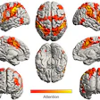 2018 04 27 16 25 3738 F Mri Music Brain Networks 20180427164405