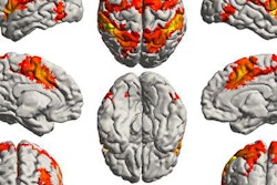 2018 04 27 16 25 3738 F Mri Music Brain Networks 20180427164405