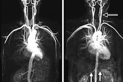 2018 05 01 16 23 6497 Rsna Srn May 1 Mra 20180501161950