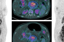 2018 05 03 00 33 9310 Jnm Theranostics 20180503002256